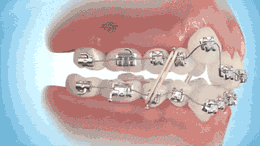 4.gif