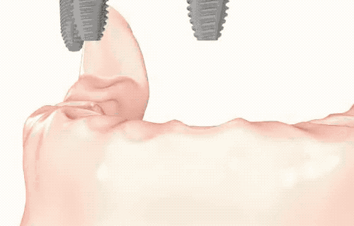 4.gif