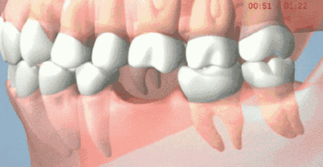 50f9b5f78e9d9842732417964e5bf28e.gif